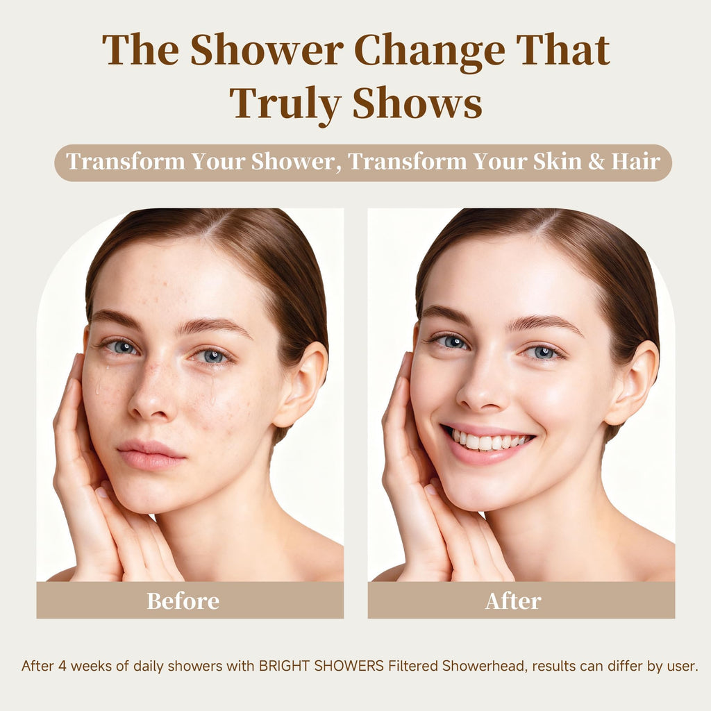 Filtered Shower Head, High Pressure Fixed Showerhead for Hard Water, Dual-Media Filter Removes Chlorine & Impurities